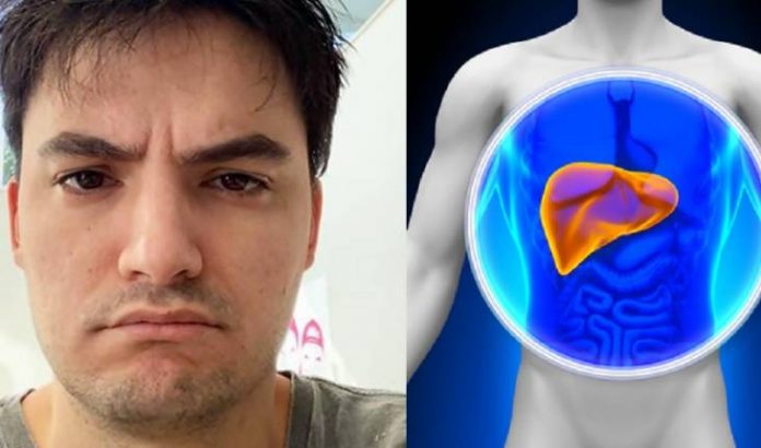 Hemocromatose: o que é, sintomas e tratamento da doença que acometeu o youtuber Felipe Neto