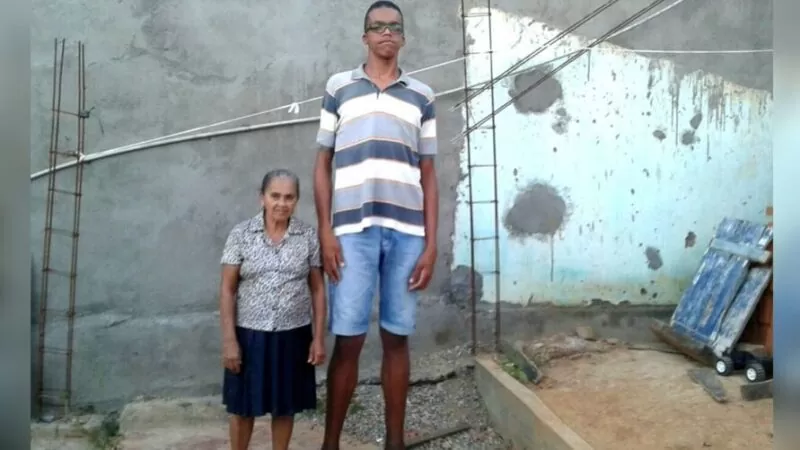 IMPRESSIONANTE: Doença misteriosa faz jovem brasileiro ter 2,18 metros