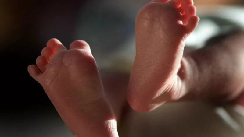 RARÍSSIMO: Bebê nasce com três pênis e é o primeiro caso no mundo