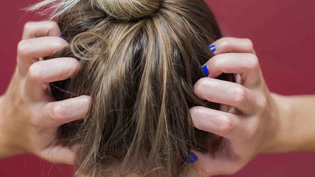 Conheça 7 causas comuns para coceira no couro cabeludo