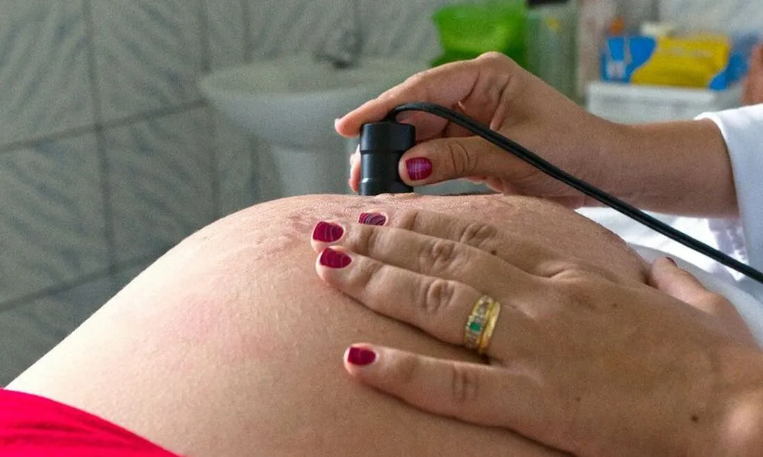 TACARATU: Munícipio recebe recomendação do MPPE por não realizar na íntegra exames de rotina previstos na assistência ao pré-natal